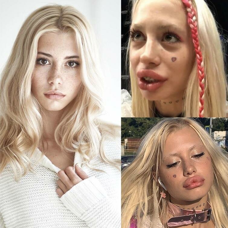 Хофманита