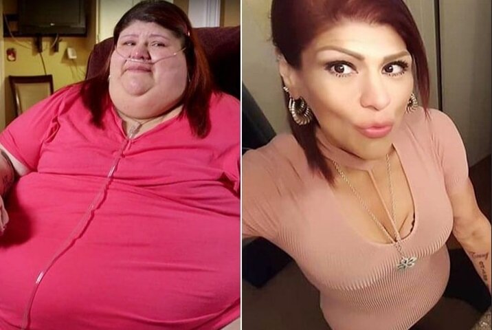 43-летняя Лаура Перес женщина, которая сбросила ошеломляющие 186 кг. "До и после".